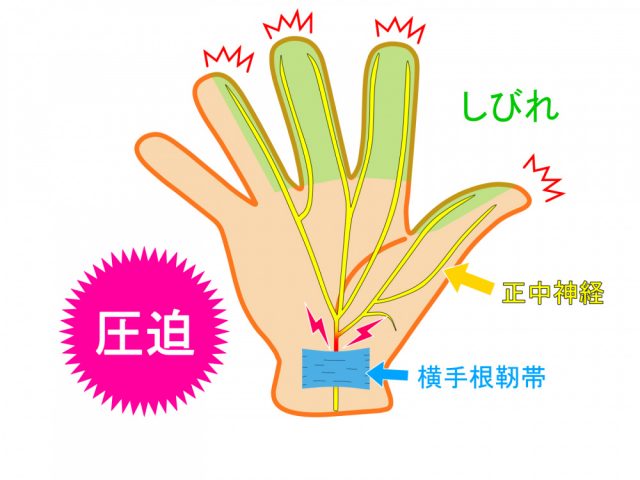 正中神経の写真